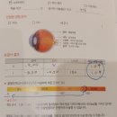 -9D 초고도근시 화정 예빛안과 검안후기(라식추천)