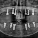의왕퍼스트치과의원 이미지