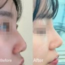 [👃🏻테스코 후기/붓기] 1분만에 완성되는 자려한코, 테스코