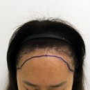 부산 맘모스헤어라인의원 이미지