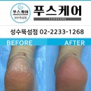 푸스케어 성수뚝섬점 네이버블로그
