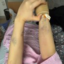 나리여성병원 제왕절개 후기#오전수술#6박7일#1인실