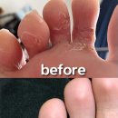 빛과소금약국 | 라미실 연고 가격 / 효능 / 약국처방 + 내돈내산 후기