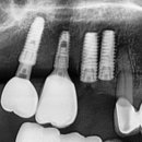 강남삼성치과기공소 이미지