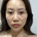 웨딩 D-57 상담과 진단이 꼼꼼한 산남동피부관리 수드림에서 예민피부 진정관리 받았어요