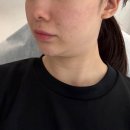압구정 다이어트병원 페이스온다리프팅 일주일 후기 (통증, 효과, 붓기, 부작용)