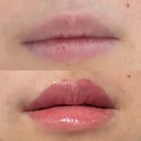 아인뷰티랩 | [구월동입술] 아인뷰티랩 인천 입술관리 후기 :: 입술라인커버