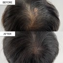 헤드샷스칼프본점 이미지