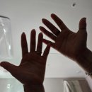 몸앤장한의원 송산새솔점 | 새솔동한의원 몸앤장송산점에서 목디스크치료중!