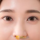 연세스타안과 이미지