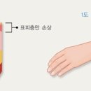 화상2 네이버블로그