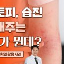 낫지 않는 건선, 아토피, 습진에 도움되는 산소치료, 체온치료, 기능의학치료(피부질환) 이미지