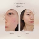 엘에스테틱 | 판교 에스테틱 엘부티끄 후기 | 베르도소 관리로 얼굴 열감 잡기