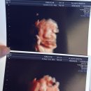 동원산부인과의원 | 31주차 전원일기 🏥👶🏻