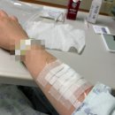 산동요양병원 | 망막박리 증상 원인 치료 : 공막돌륭술 후기 ..