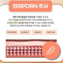 겨울철 속건조 리쥬란 힐러 겉촉속촉 2cc 후기(1주일 사진+)