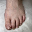 좋은세상의원 | 구파발역 365이화웃는세상의원이 구파발 내성발톱 치료 병원으로 1등이네요 👍🏻