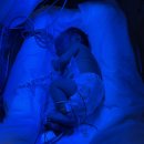 세브란스산부인과의원 | 신생아 황달 강남 세브란스병원 NICU 입원기