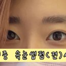 스마일데이지(Smile Daisy) 이미지