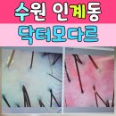 닥터모다르 수원점 | 수원두피관리 닥터모다르 방문 후기, 인계동에서 두피 고민 해결해요