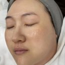 제이비비 이미지