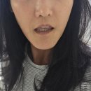 슈어메디 리포좀 글루타치온 시그니처9S 후기와 글루타치온 필름 먹는법 총정리