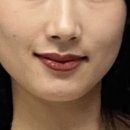 작은얼굴에스테틱