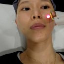 나노병원 | 공덕역 피부과 제네시스, 나노피코토닝 차이점 및 효과 후기