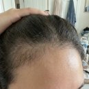 (주)링크맥스 | 서리맥스 내돈내산 후기 먹기편한 서리태영양제 추천