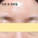 에스트라 아토베리어 365 하이드로 에센스 200ml 사용 후기