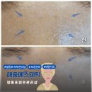해움에스테틱