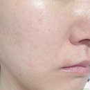 목화약국 | 피부 트러블 진정 토너패드 내돈내산 훅이