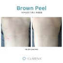 브라운필 이미지