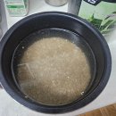 신일치과의원 | 사랑니를 뽑고 나니 나는 직장도 좋은 성적도 친구도 죽 끓여줄 여친도 없다는 것을 깨달음 | 사랑니...