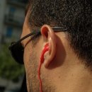 한미보청기 이미지