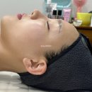 새천년대로 | 포항하이푸리프팅 새미모포항점 후기