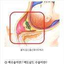 결정적순간 - 안양시 만안구 오리로34번길 25-17 | 맥수술 꼭 해야 할까? 조산 막는 결정적 순간 (+실제 산모 후기)