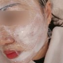 루비 | 대구 루비레이저 후기