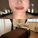원주 윤곽관리 뷰티더아인 에스테틱 로얄5케어 전후비교 솔직후기