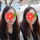 서울윌치과 | 치아교정 1년 4개월만에 끝난 ssul..③ 교정 그 후 이야기