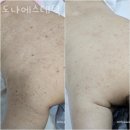 도나에스테틱 | 신사동피부관리 도나에스테틱 위치.가격.시간.후기