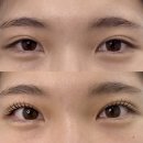 유성온천대온탕 | [대전] 봉명동 채우다뷰티 클리닉펌 후기 연장한 것 같은 효과