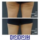 인천비만클리닉 여기서 대비해요!