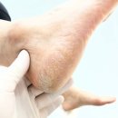 레푸스김포걸포점 | [김포각질관리] 레푸스 김포걸포점 재방문 아기발 만든 솔직후기