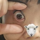 나무온누리약국 | 전주 온누리안과병원 스마일라식 후기