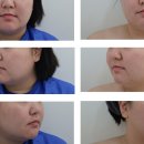 모멘텀헤어라인의원 이미지