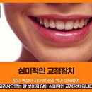 아름다운바른이치과교정과치과의원 | 강서구 치아교정 치과 벌어진 앞니 부분교정으로 치료하세요ㅣ추천