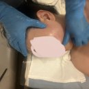 아주르 | 비대칭 고민 끝! 부산윤곽관리 &#34;아주르스파&#34;윤곽베이지케어 후기 (비포애프터)