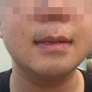 피카브로우 이미지