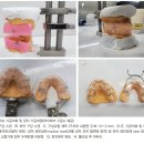 하이테크 치과기공소 네이버블로그